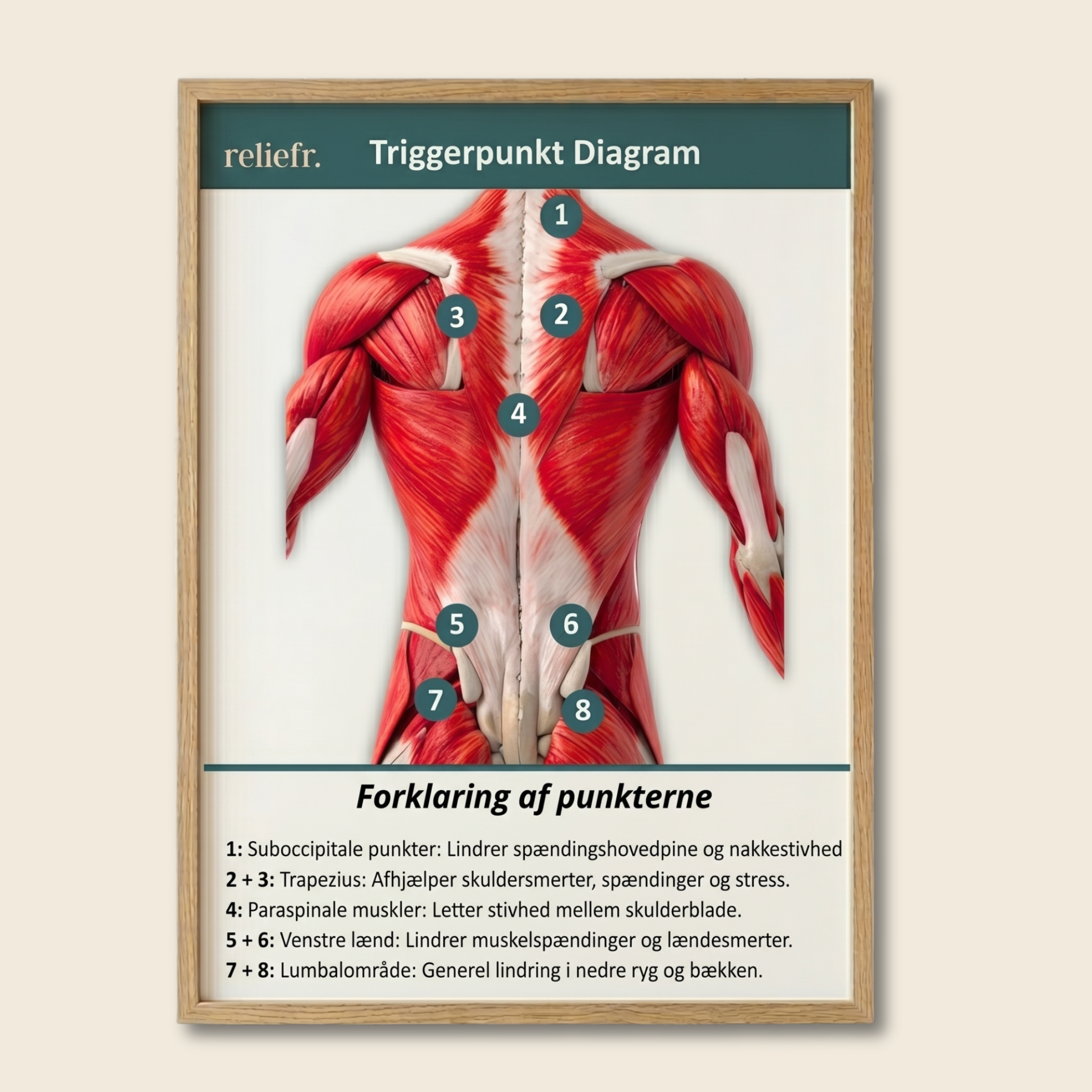 Trigger point diagram